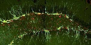 アルツハイマー病のマウスの脳が若返り、認知機能改善に成功と理研など発表
